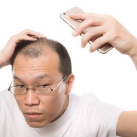 スマホの自撮りで薄毛をチェックする禿げ男性の写真