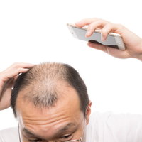 頭頂部から後頭部にかけてスマートフォンで薄毛具合をセルフチェックする男性の写真