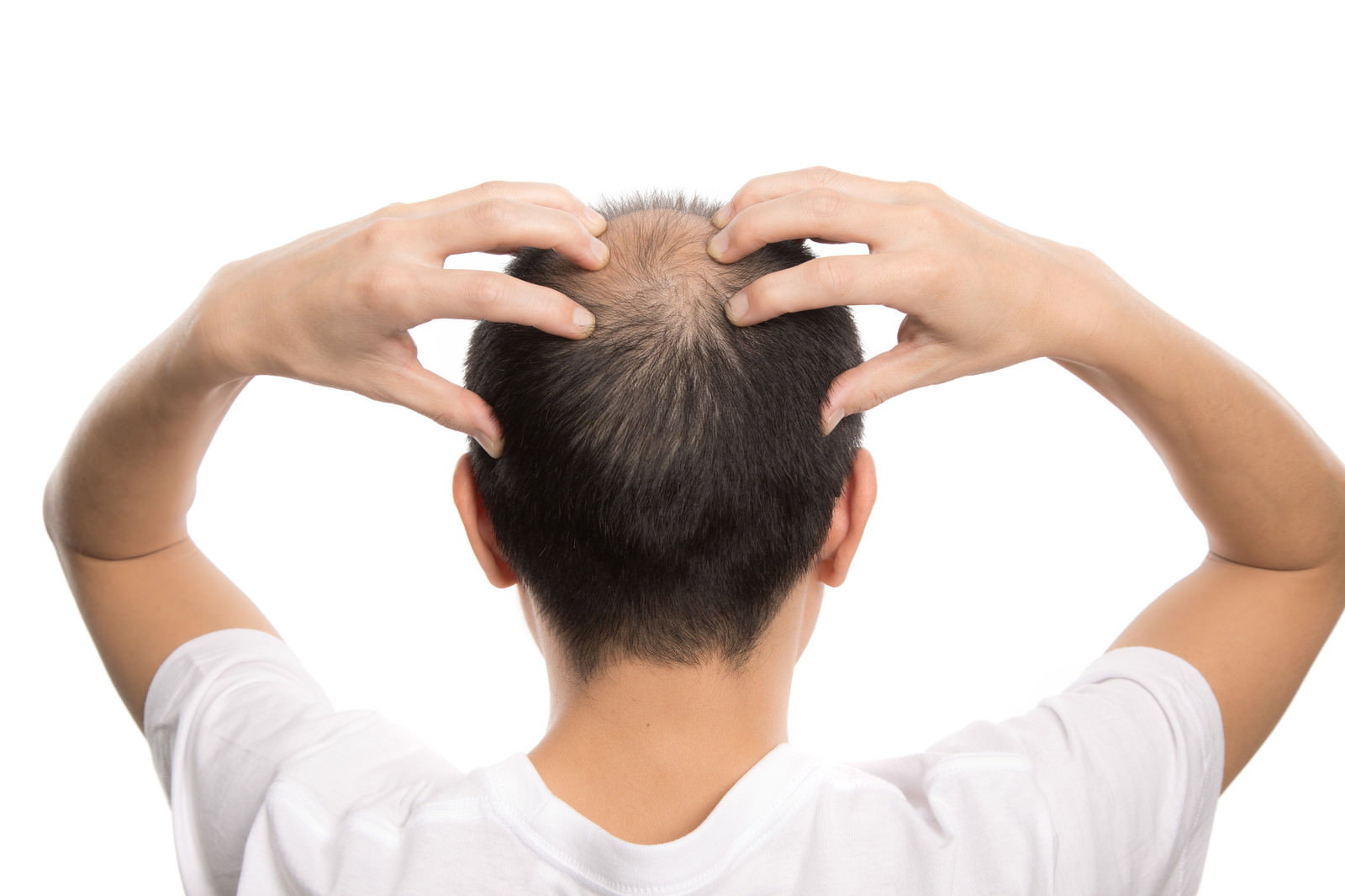 白いTシャツを着た男性が両手で頭頂部をマッサージしている背後からの写真［モデル：サンライズ鈴木］