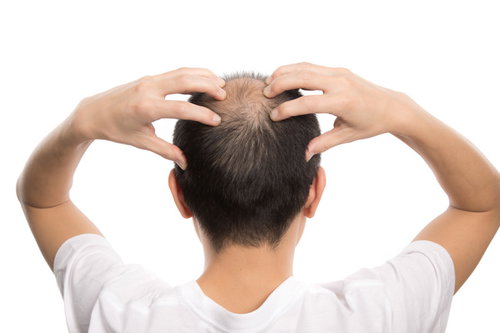 頭頂部を両手でマッサージする薄毛男性の背後姿