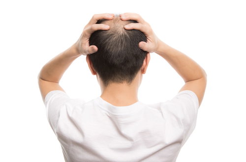 頭を抱える禿げた男性の後ろ姿でストレスと悩みを表現