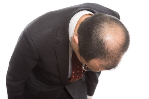 お辞儀をすると頭頂部ハゲが分かりやすい！ まさにカッパ状態