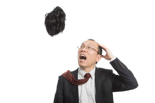 神様から毛髪を取り上げられたハゲリーマン