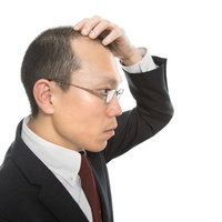 剃り込みが後退するM字ハゲに悩むスーツ姿の会社員の写真