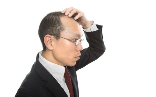 剃り込みが後退するM字ハゲに悩むスーツ姿の会社員
