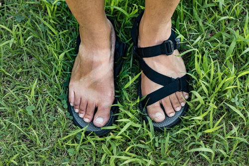 黒いサンダルで足元に残る日焼けの跡、紫外線対策の重要性を示す夏の