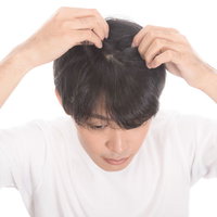 毛根をチェックする若い男性のAGA対策と薄毛予防の写真