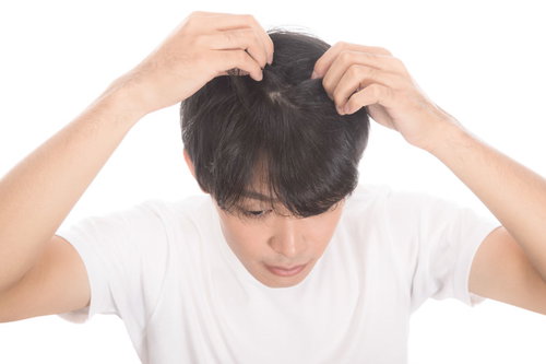 毛根をチェックする若い男性のAGA対策と薄毛予防