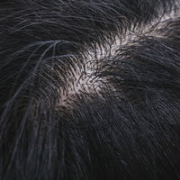 ふさふさの頭髪と頭皮のヘアチェックの写真