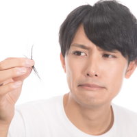 頭髪の抜け毛が気になりはじめる若い男性の頭部の写真