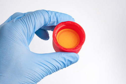 青い医療用手袋で赤いキャップの除草剤容器を持つ