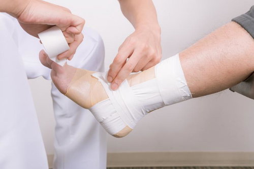 足首にテーピングを巻いている様子、捻挫や骨折などの治療
