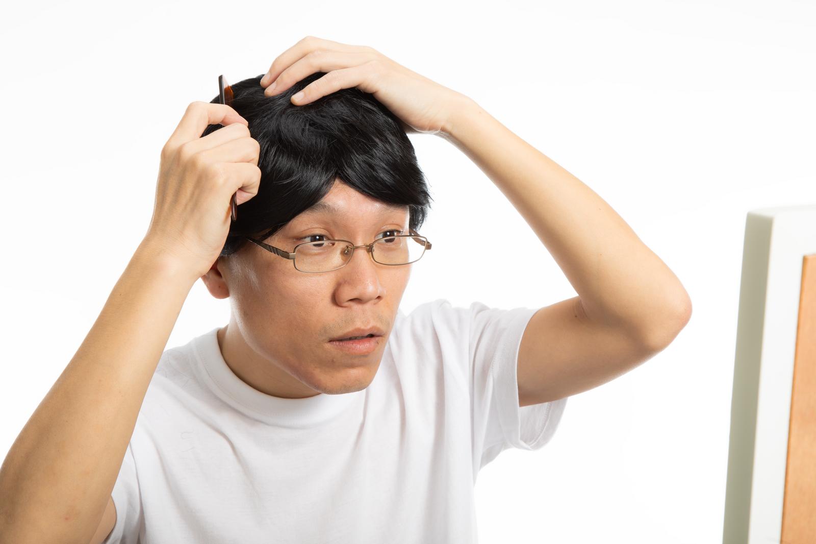 カツラを手に取りながら頭を気にする眼鏡をかけた男性［モデル：サンライズ鈴木］