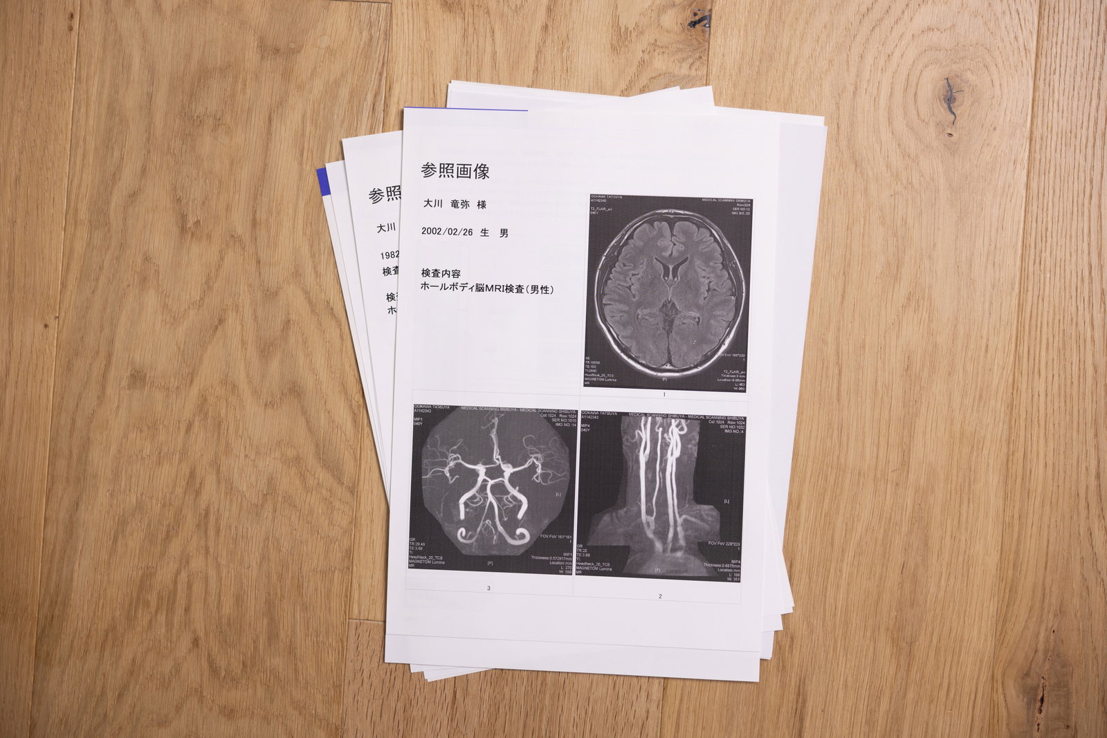脳MRI検査の参照画像が印刷された書類［モデル：大川竜弥］