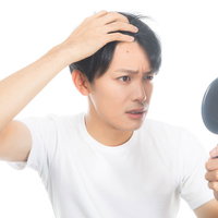 不摂生でおでこにニキビができた男性の肌トラブルの写真