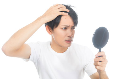 不摂生でおでこにニキビができた男性の肌トラブル