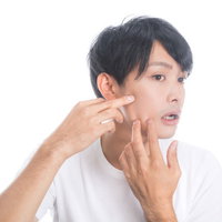 頬のニキビを気にするスキンケアに悩む男性の写真