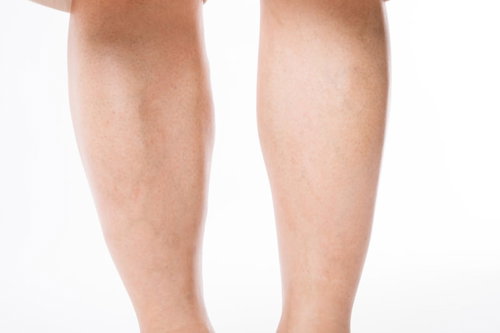 除毛後の滑らかな両足