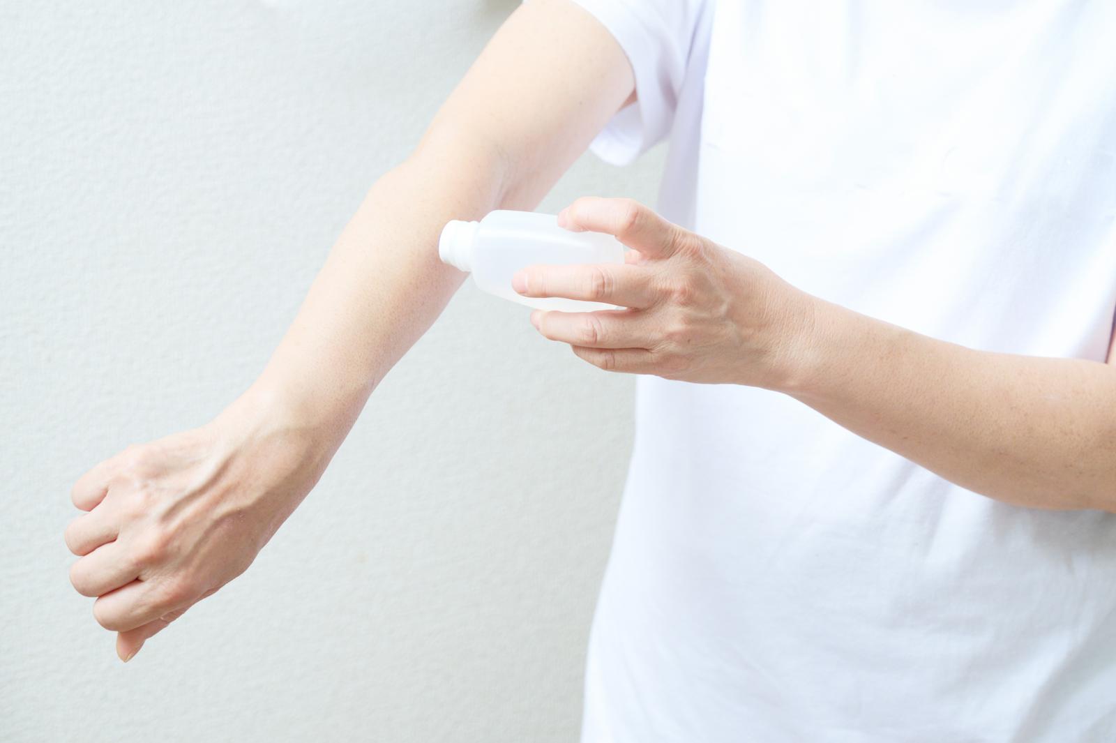 虫刺された腕にかゆみ止めクリームを塗る女性の手元